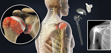 Orthopedic Surgeon in Ahmedabad Orthopedic Surgeon in Ahmedabad